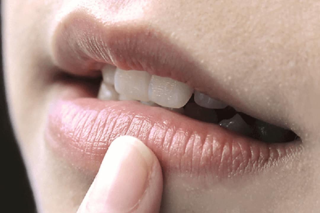 Khử thâm môi bằng tác động bên ngoài đối với nguyên nhân từ bẩm sinh