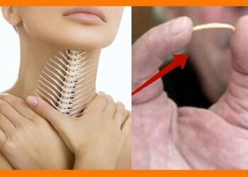 Hóc xương cá xảy ra khi bạn không lọc xương hoặc ăn cá quá vội