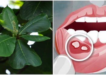 Mách bạn cách chữa nhiệt miệng bằng lá bàng đơn giản mà hiệu quả