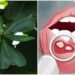Mách bạn cách chữa nhiệt miệng bằng lá bàng đơn giản mà hiệu quả