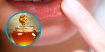 Các bước cơ bản khử thâm môi bằng mật ong