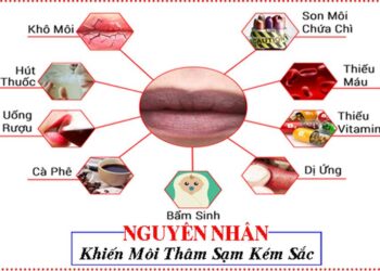 Nguyên nhân môi bị thâm là gì?